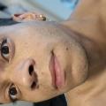 ALISSON